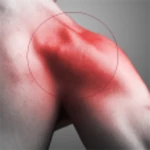 Logo of Rotator Cuff Tear Exercises android Application 